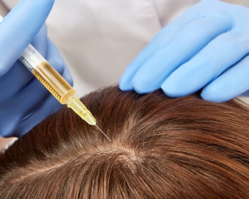 Exosome therapy for hair