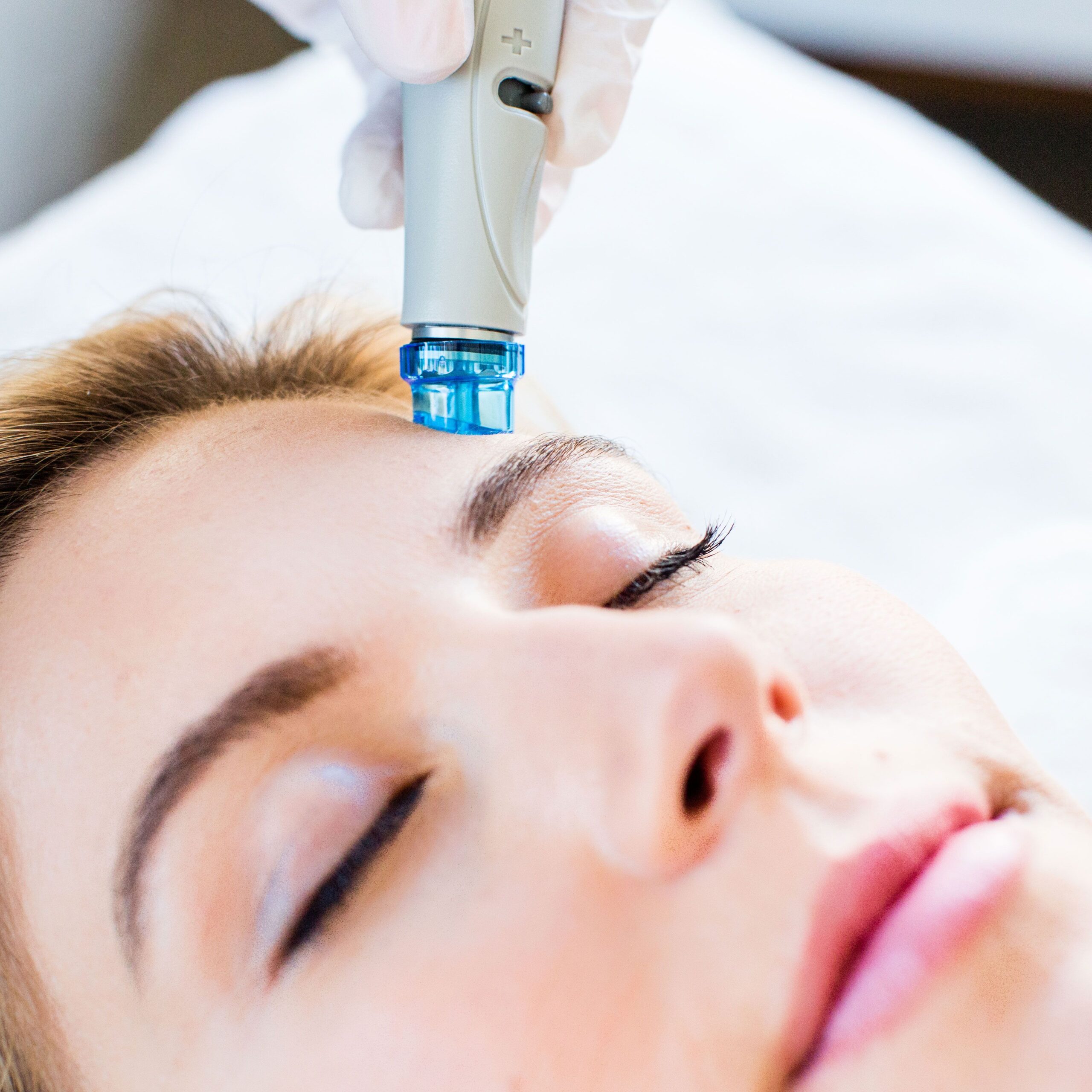 Can HydraFacial Help You Achieve Naturally Radiant Skin: - Newsglo