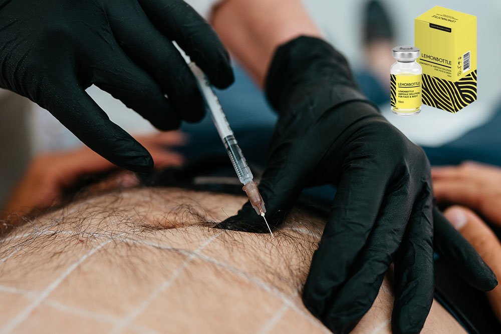Lemon bottle fat dissolving injections