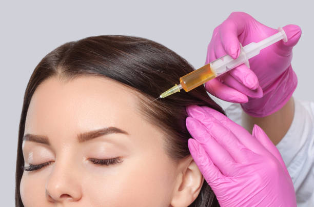 PRP Hair Treatment in Riyadh