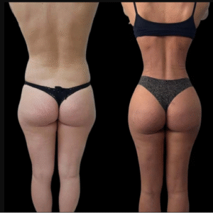 A Complete Guide to J-Plasma by the Best Plastic Surgeons in Dubai - Newsglo