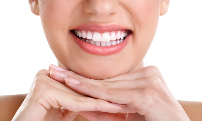 What Makes Teeth Whitening a Popular Smile Upgrade
