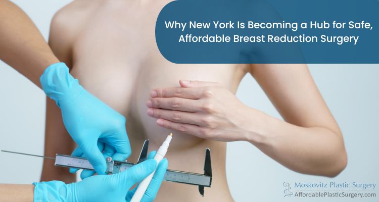 Why New York Is Becoming a Hub for Safe, Affordable Breast Reduction Surgery - Newsglo