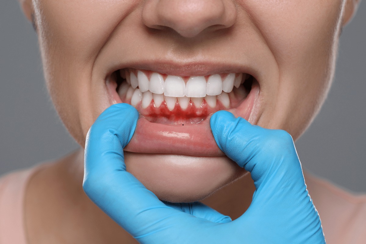 How Serious Is a Tooth Abscess Without Emergency Treatment? - Newsglo
