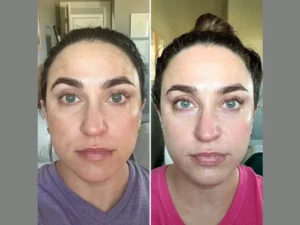 What Makes the Best Plastic Surgeons in Dubai Experts in Skin Tightening? - Newsglo What Makes the Best Plastic Surgeons in Dubai Experts in Skin Tightening? - Newsglo