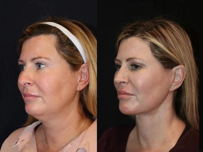 What Makes the Best Plastic Surgeons in Dubai Experts in Skin Tightening? - Newsglo