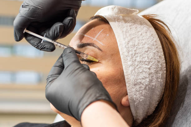 Does Under Eye Filler Help With Eye Bags?