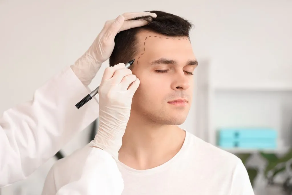 Hair Transplant in Dammam aljubail