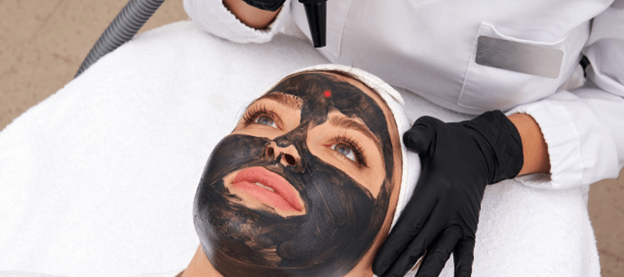 Laser Carbon Peel A Gentle Yet Powerful Facial Treatment