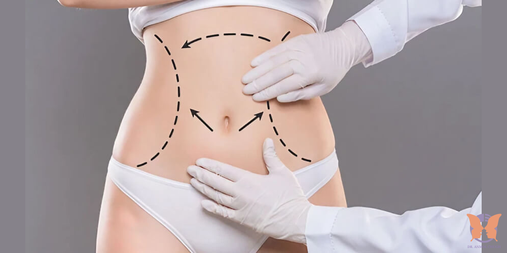 Liposuction Benefits