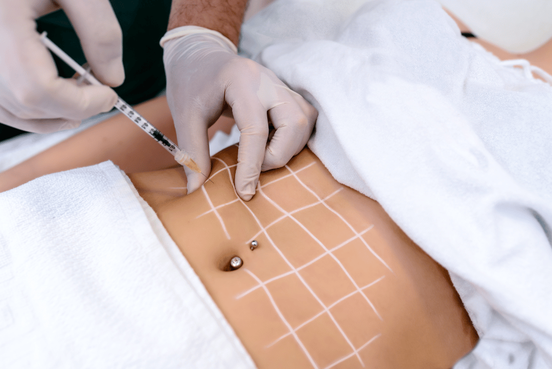 How Weight Loss Injection Improves Weight Management