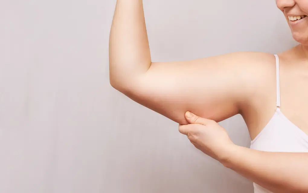 Is Arm Lift a Permanent Body Contouring Solution