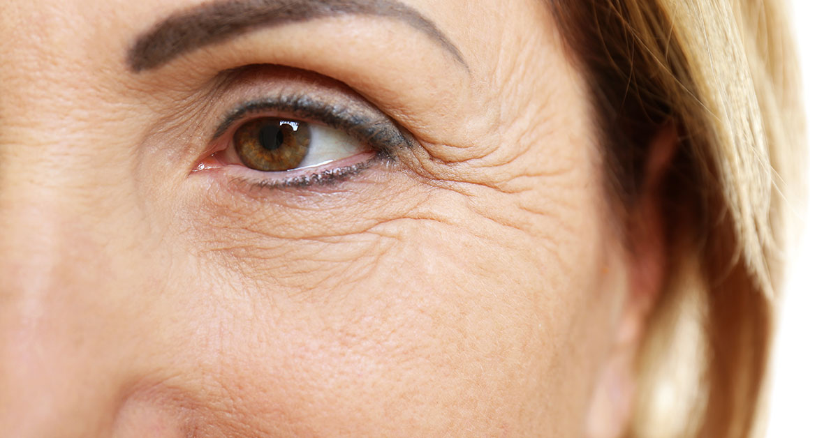 Is Fine Lines and Wrinkle Removal Long Lasting