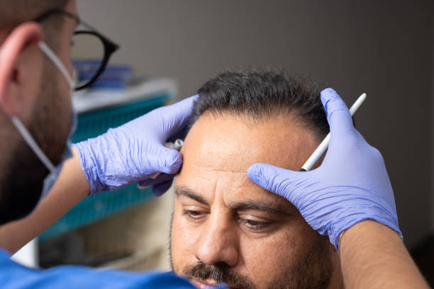 Is Hair Transplant Safe with Modern Methods
