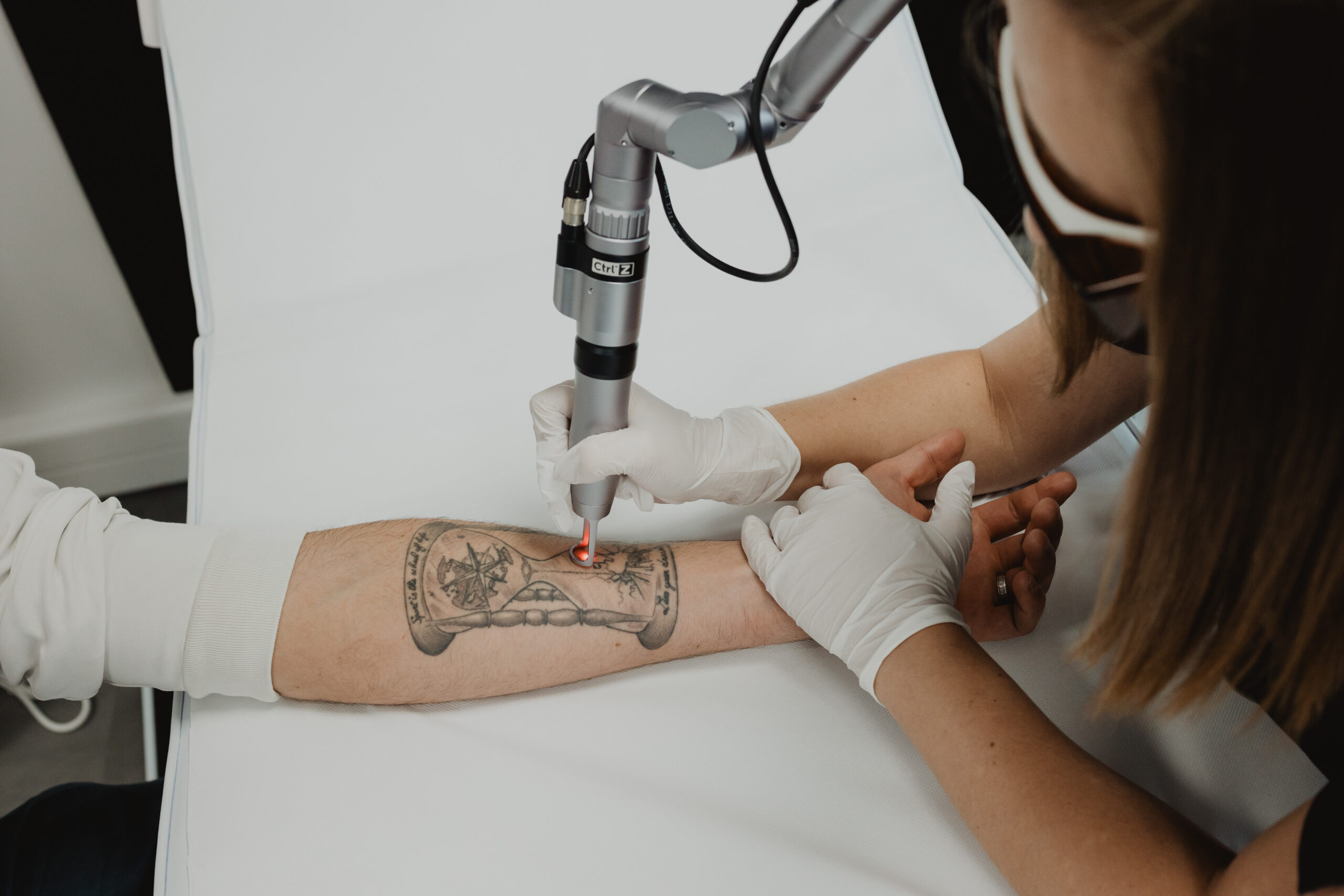 Is Laser Tattoo Removal Suitable for Large Tattoos?