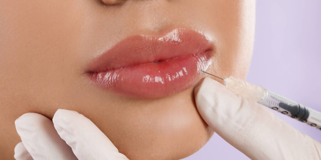 Is Lip Filler Painful During the Procedure?