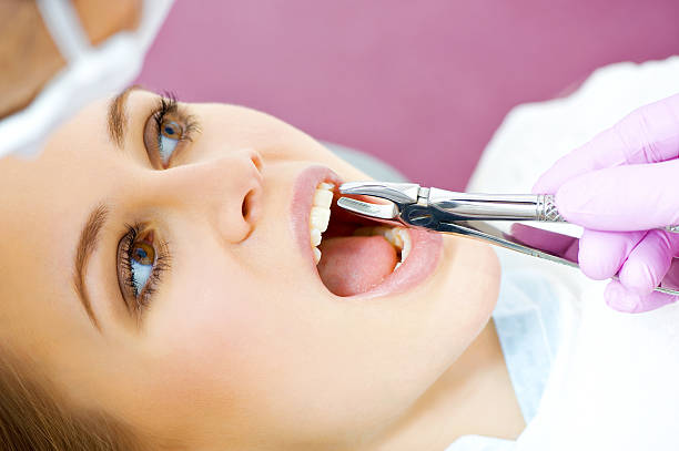 Is Tooth Removal Better Than Root Canal