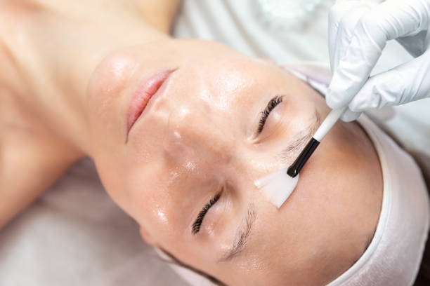 Is a Chemical Peel Good for Skin Rejuvenation?