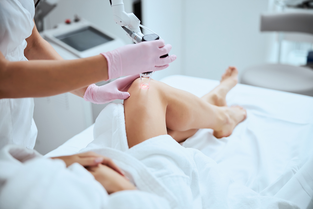 Non-Surgical and Surgical Varicose Veins Solutions