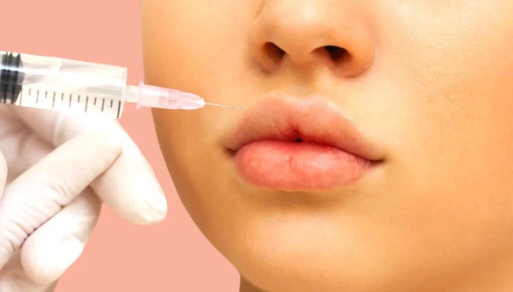 Russian Lip Technique for Refined Lip Shape