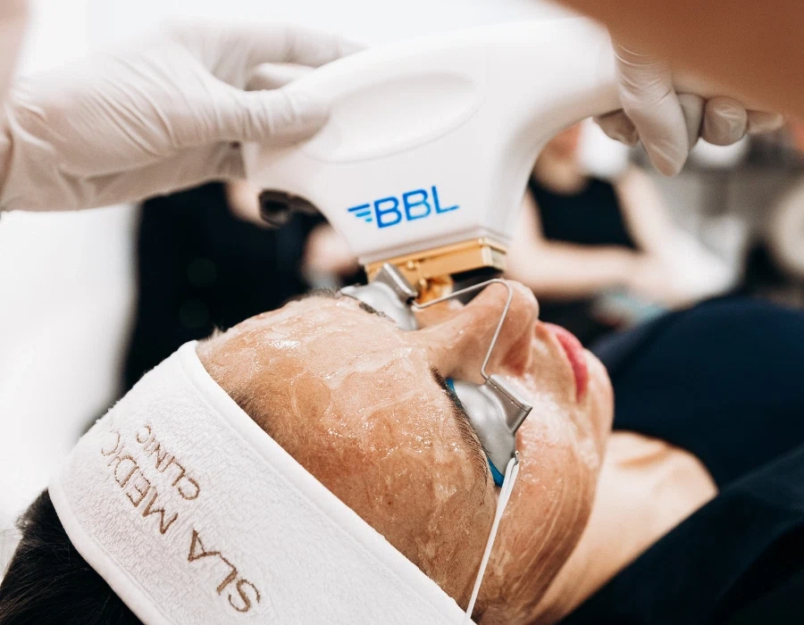 Skin Repair & Renewal with BBL Laser in Manchester - Newsglo Bbl Laser In Manchester