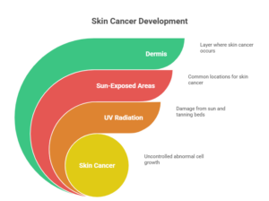 Best Skin Cancer Treatment in Noida