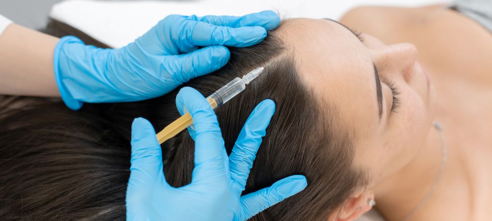 PRP hair treatment in Mississauga