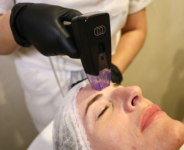 Can Morpheus8 Help Firm Sagging or Loose Skin?