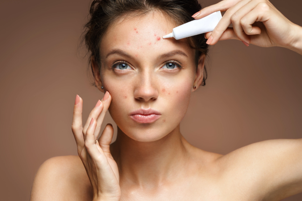 Advanced Acne Treatment for Smooth Skin