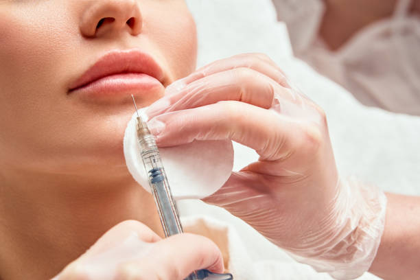 Are Lip Fillers Safe for First-Time Patients