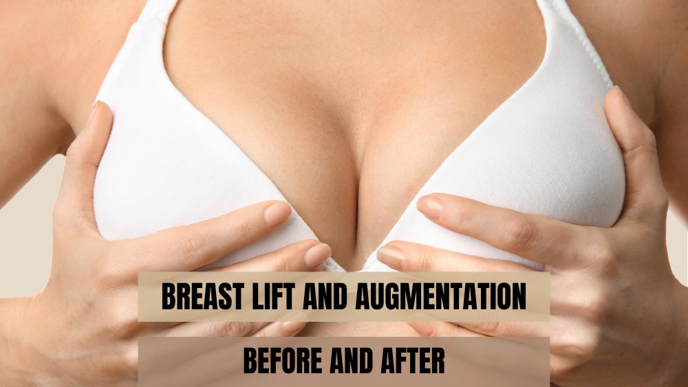 Understanding Breast Enhancement: Options, Benefits, and What to Expect - Newsglo