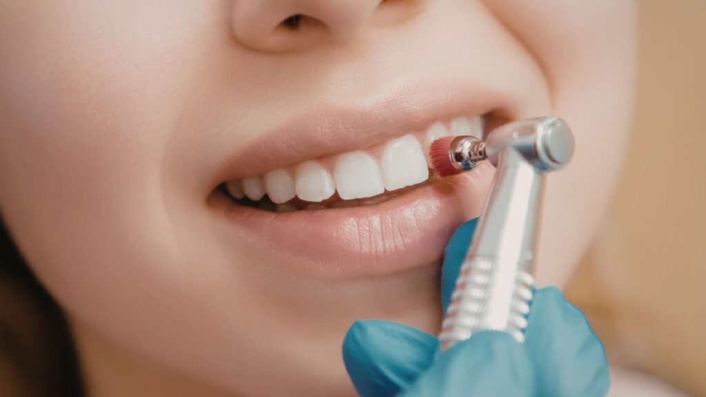 Dental Insurance Market