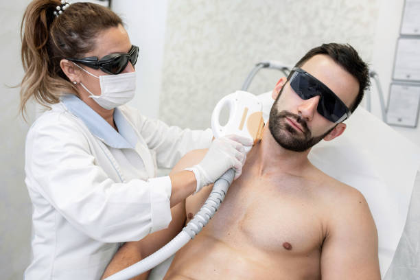 Does Men’s Laser Hair Removal Reduce Ingrown Hairs