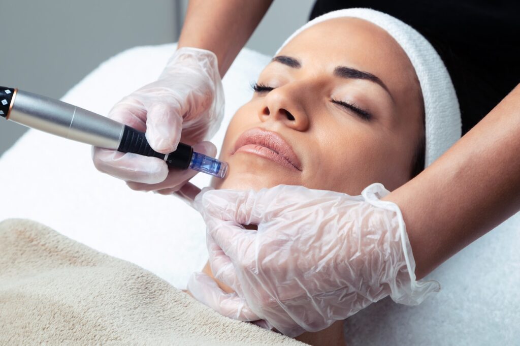Does Mesotherapy Provide Long-Term Skin Benefits