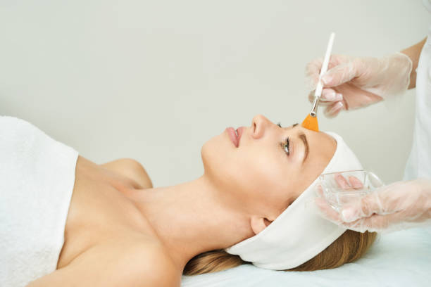 Does a Chemical Peel Improve Oily Skin Problems