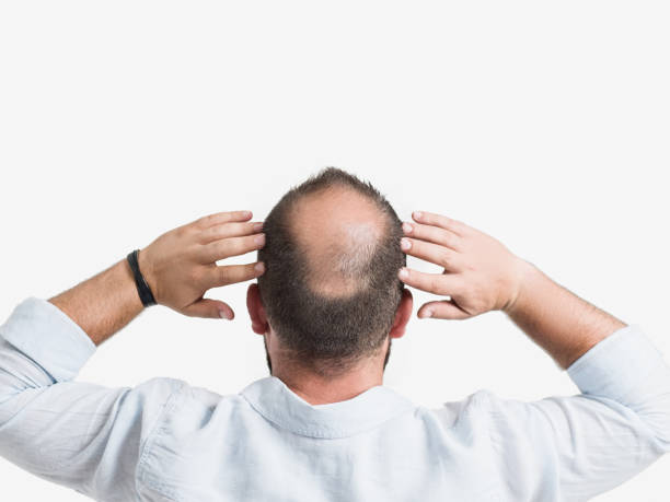 Dose GFC Hair Treatment Thicken Thin Hair