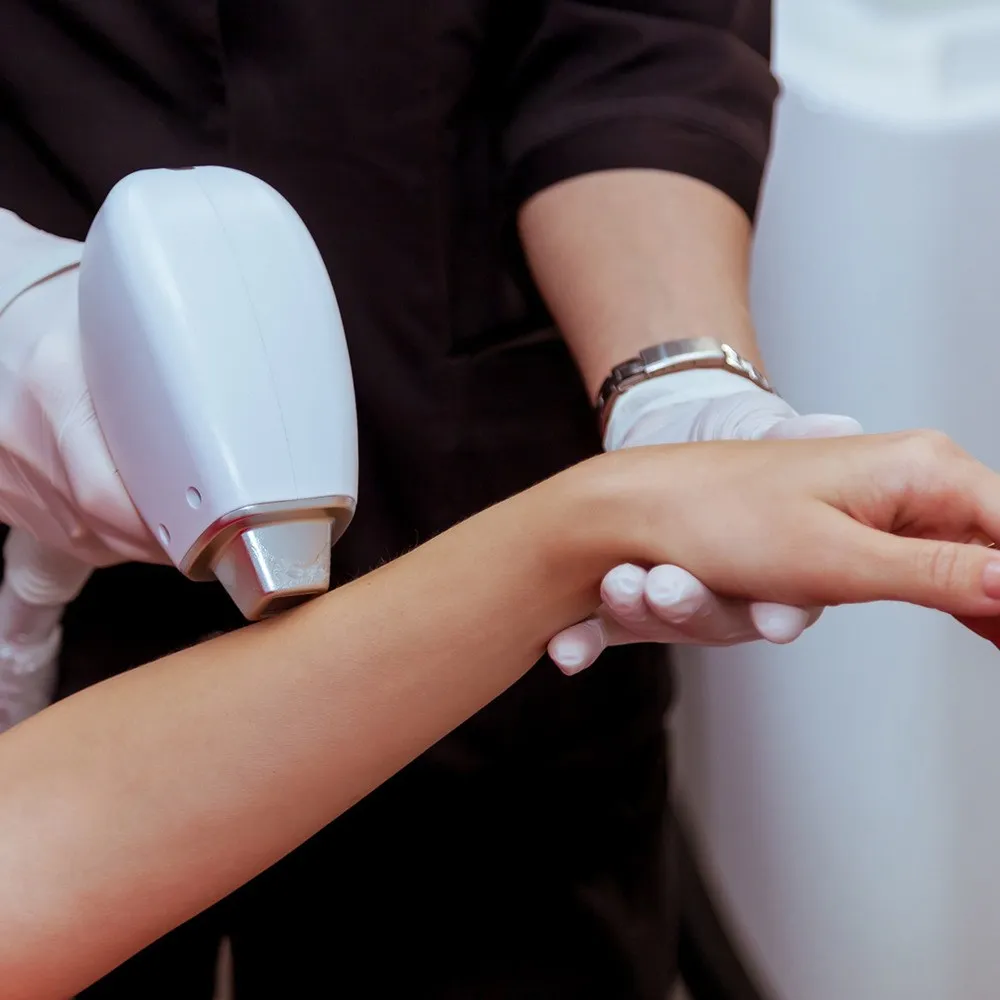 Gentle and Effective Laser Hair Removal