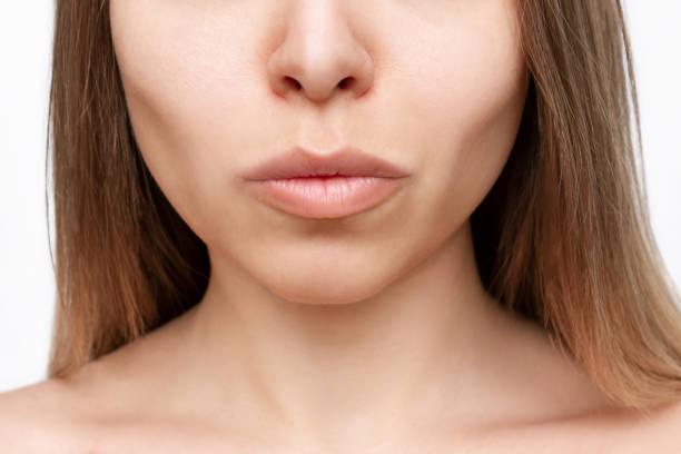Is Buccal Fat Removal Right for You