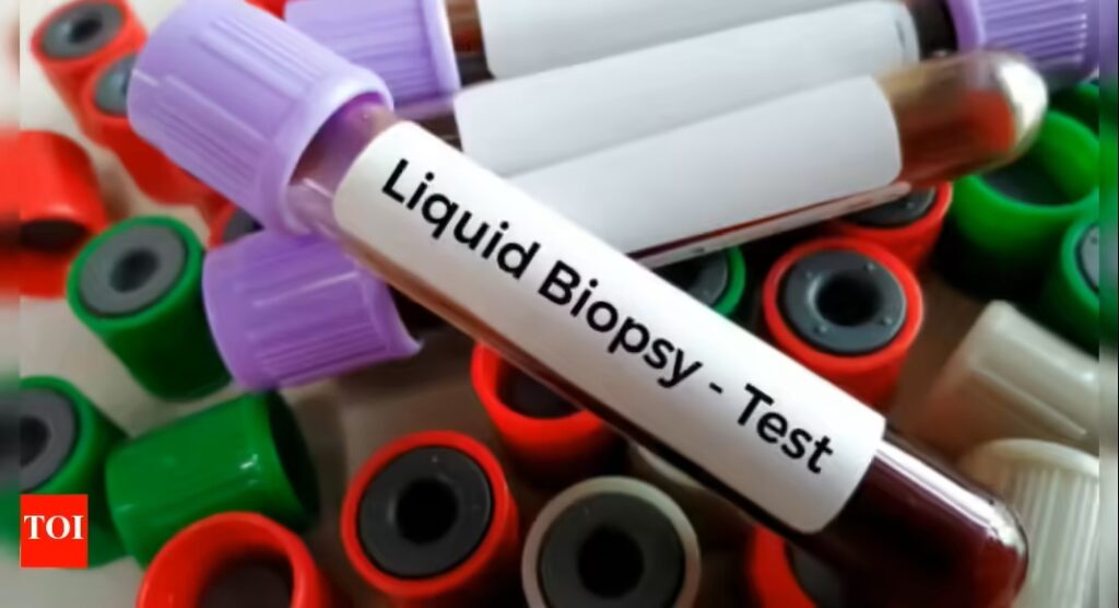 liquid biopsy test.
