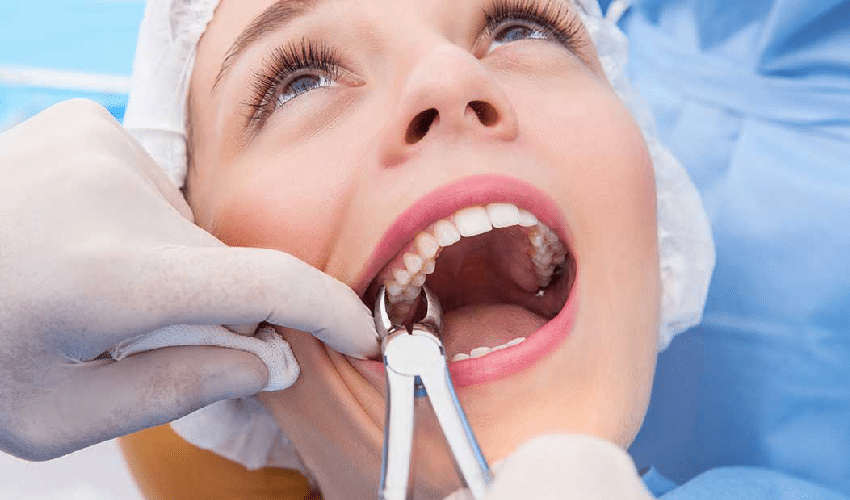 Pain-Free Tooth Extraction Options on Bandera Rd - Newsglo