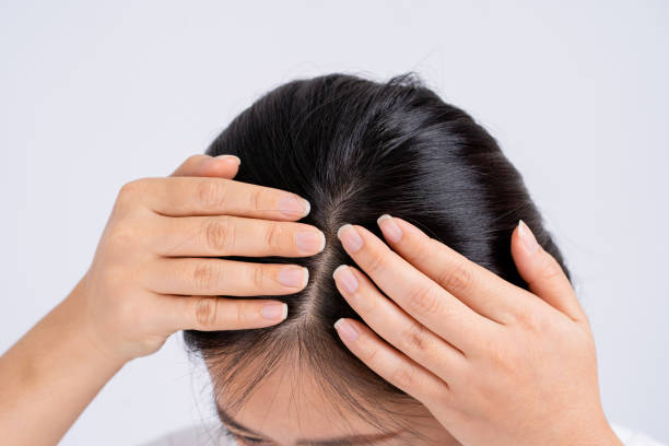 What Are the Most Effective Treatments for Hair Loss