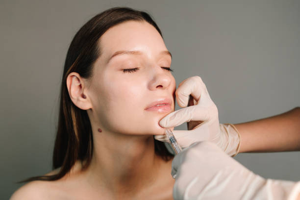 What Makes Jawline Filler a Popular Choice?
