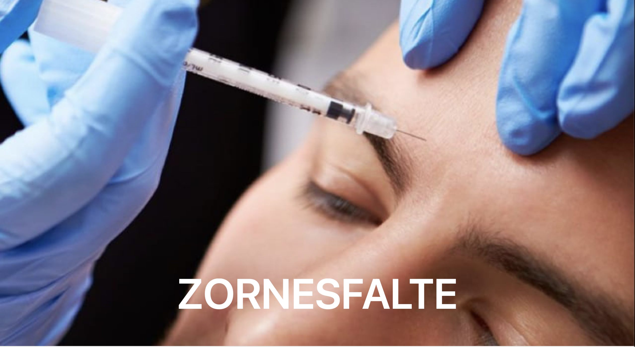 Top 3 Kliniken für Botox in Zürich (Zornesfalte) im Vergleich - Newsglo