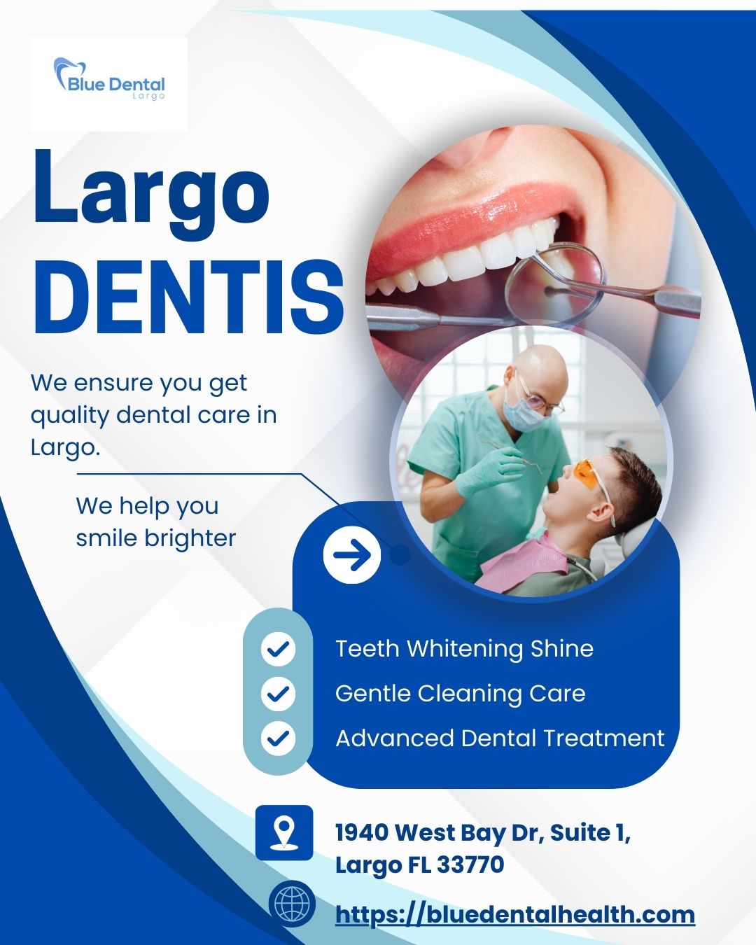 Teeth Whitening in Largo: Transform Your Smile with Professional Care - Newsglo