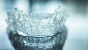 Why Choosing a Certified Invisalign Provider Makes All the Difference - Newsglo