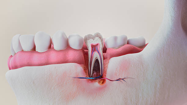 Keep Your Teeth Healthy with Expert Dental Fillings