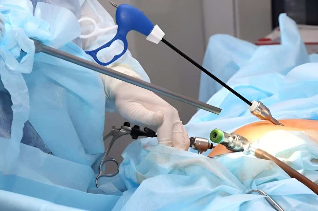 laparoscopic surgery in islamabad