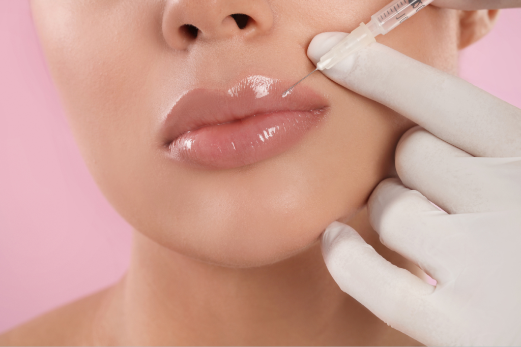 How Much Filler Is Needed for Lip Enhancement?