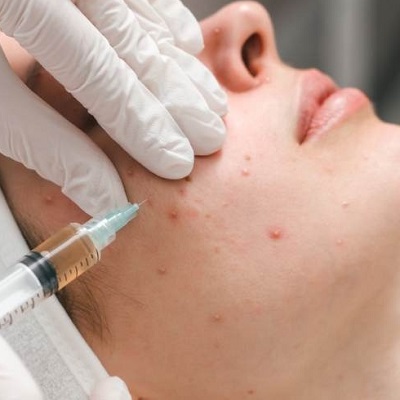 أطباء الجلدية مسقط