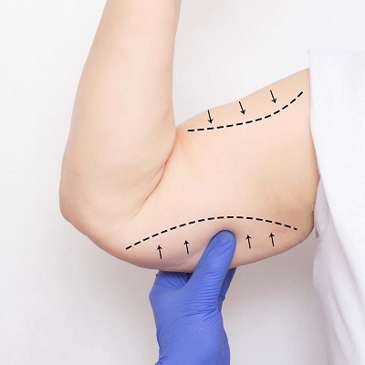 أفضل شد الذراعين في مسقط